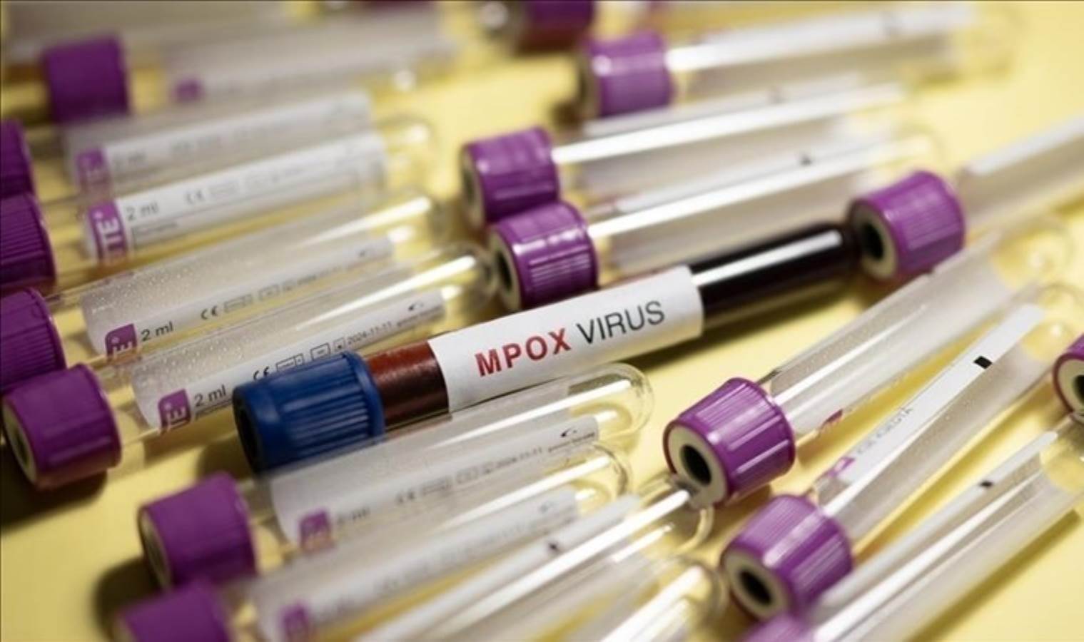 WHO approves 1st mpox diagnostic test for emergency use