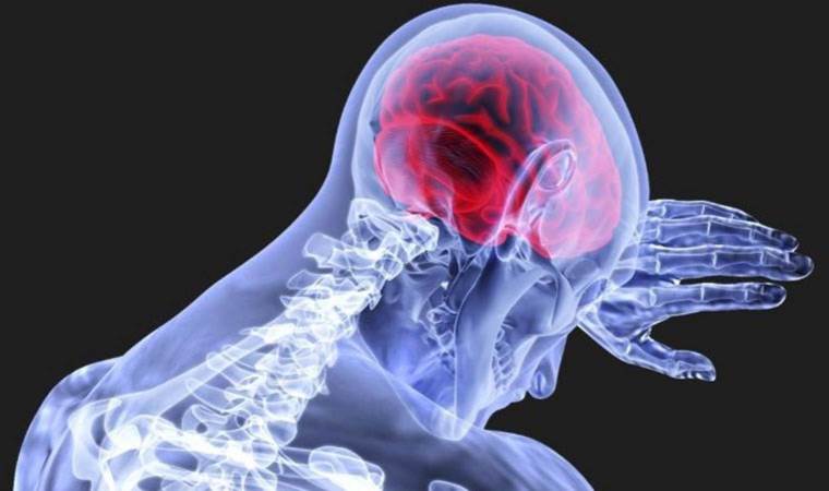 Coffee, soda, and stroke risk: What you need to know