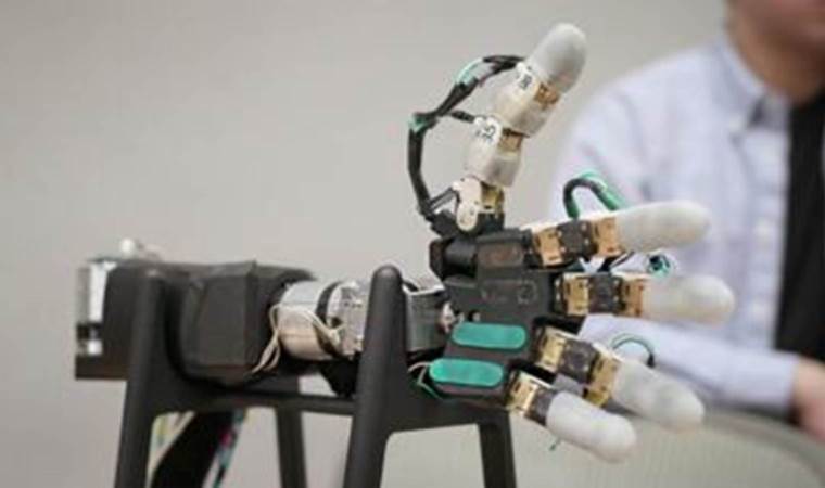 Revolutionizing prosthetics: The AI-powered bionic arm