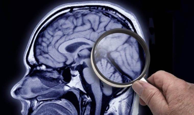 Dementia and Alzheimer's: Symptoms and treatments