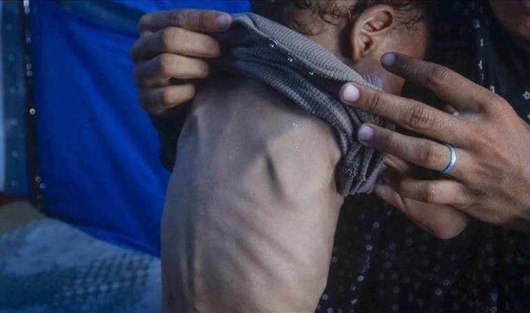 UN report warns of deepening hunger crisis in 16 global