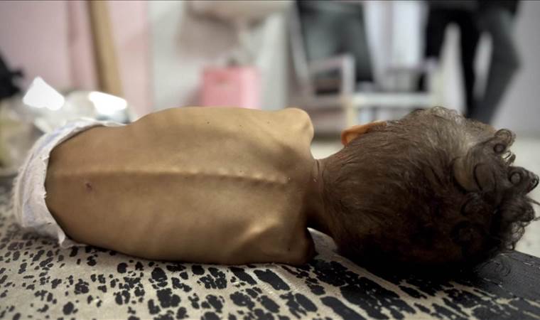 Israeli blockade causing starvation in Gaza: Axios