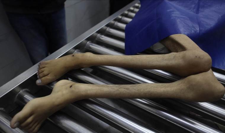 4 more Gazans die of starvation under Israeli siege