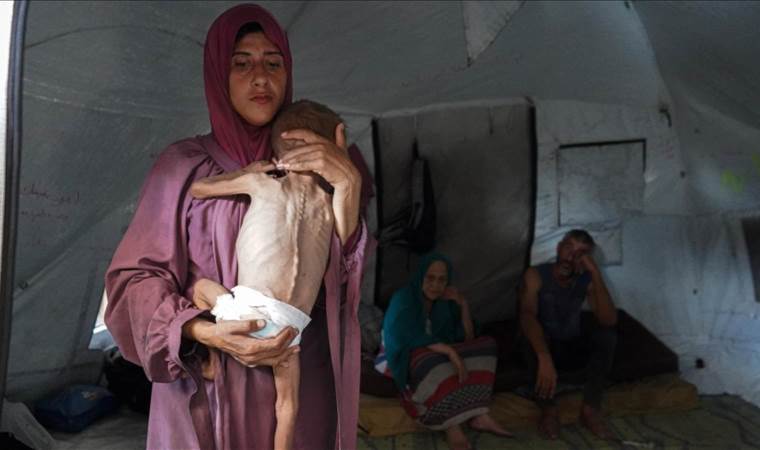 6 more die of Israel-induced starvation in Gaza, taking