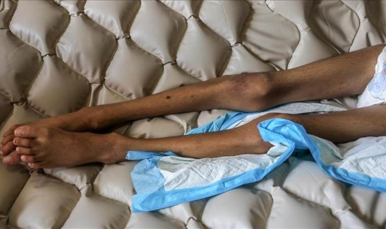 6 more Palestinians die of starvation in Israel-besieged Gaza