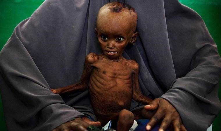 6.5M people in Somalia expected to face acute food insec 6.5M people in Somalia expected to face acute food insec