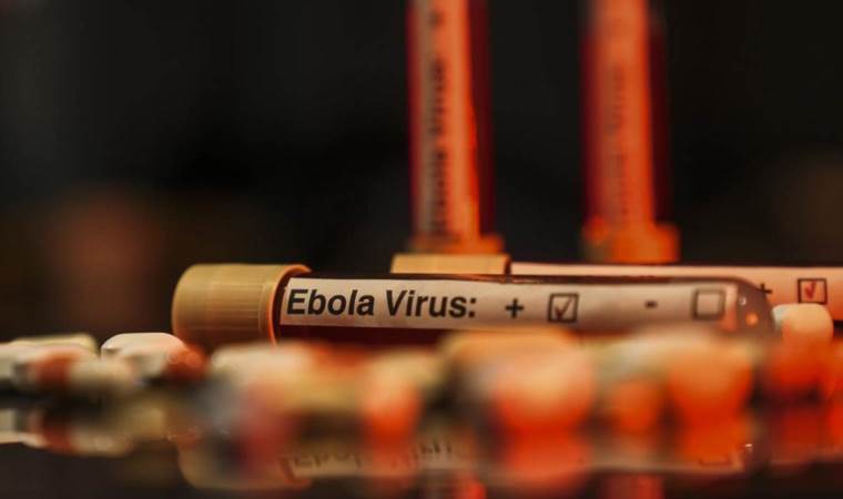 DR Congo’s confirmed Ebola cases surpass 5,000 DR Congo’s confirmed Ebola cases surpass 5,000